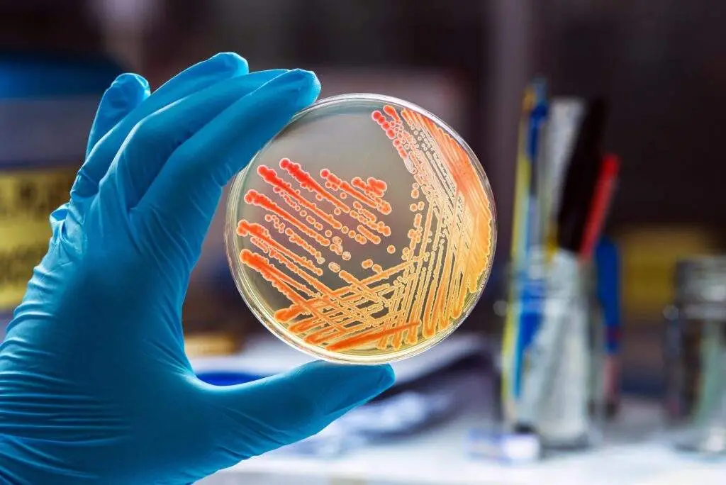 Nitrile Gloved hand holding culture smear on petri dish.