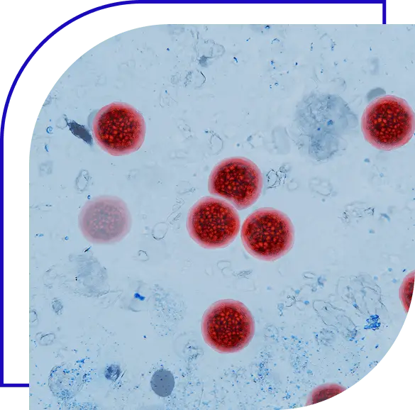 Microscopic view of Cyclospora cayetanensis oocysts under magnification, stained bright red. cyclosporiasis outbreak, foodborne parasites, intestinal infections. water pollution, concept idea.
