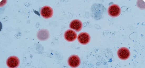 Microscopic view of Cyclospora cayetanensis oocysts under magnification, stained bright red. cyclosporiasis outbreak, foodborne parasites, intestinal infections. water pollution, concept idea.