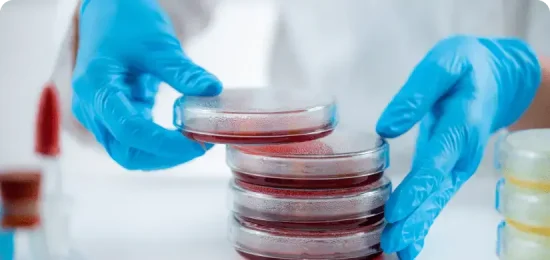 Lab-Contaminations-in-Finished-Product-Testing